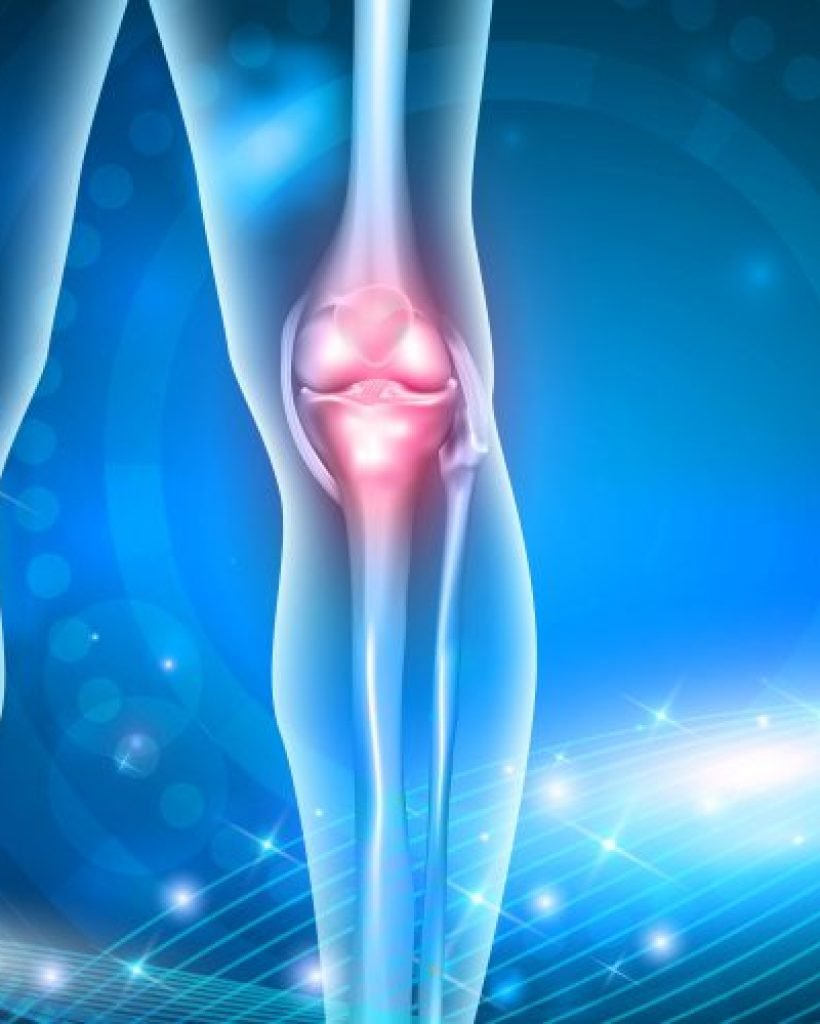 osteoarthritis